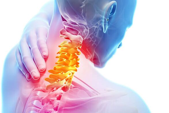 Die Hauptsymptome einer Osteochondrose sind Schmerzen und Unwohlsein.